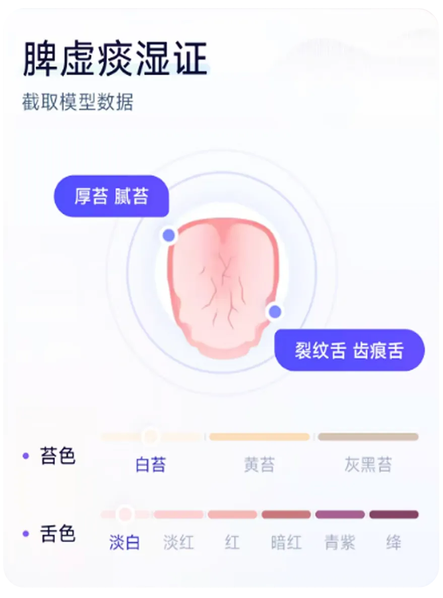 脾虚痰湿证舌象特征识别示意
