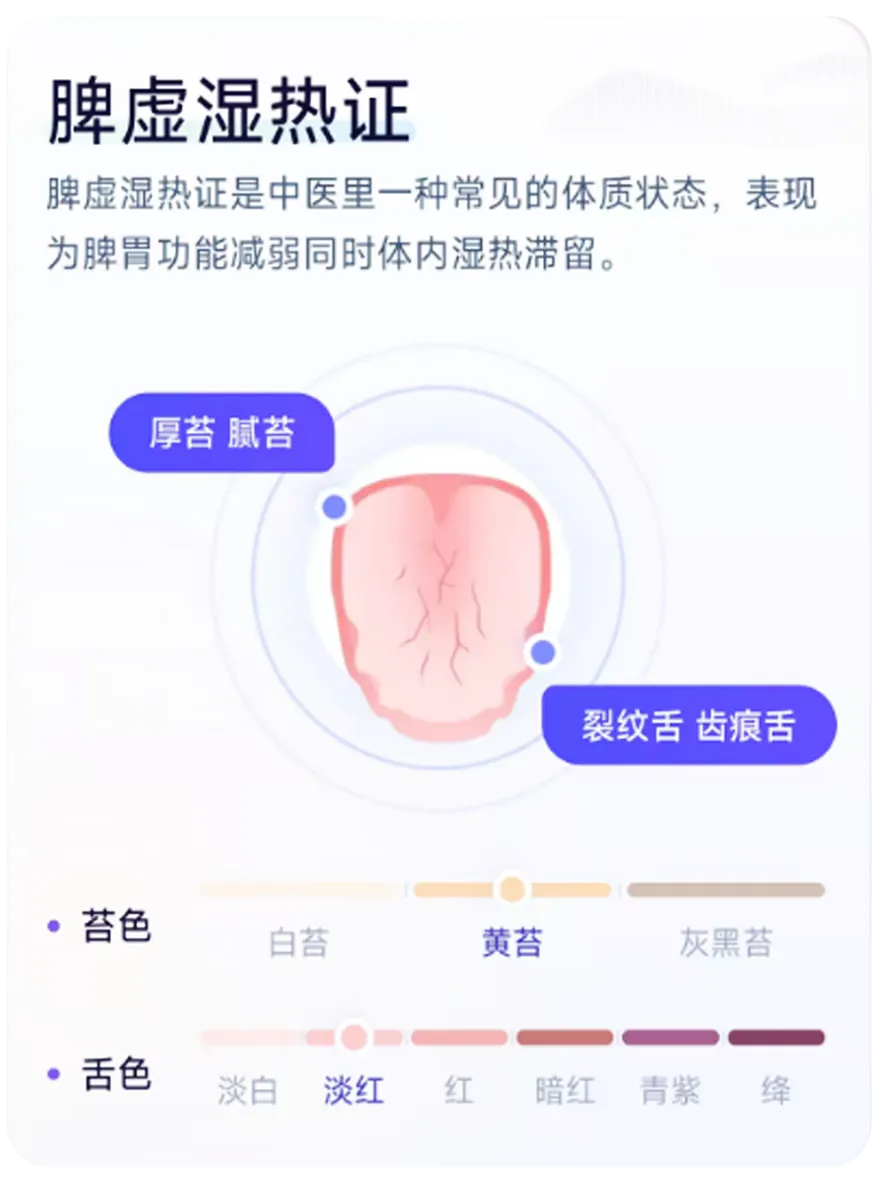 脾虚湿热证舌象特征识别示意