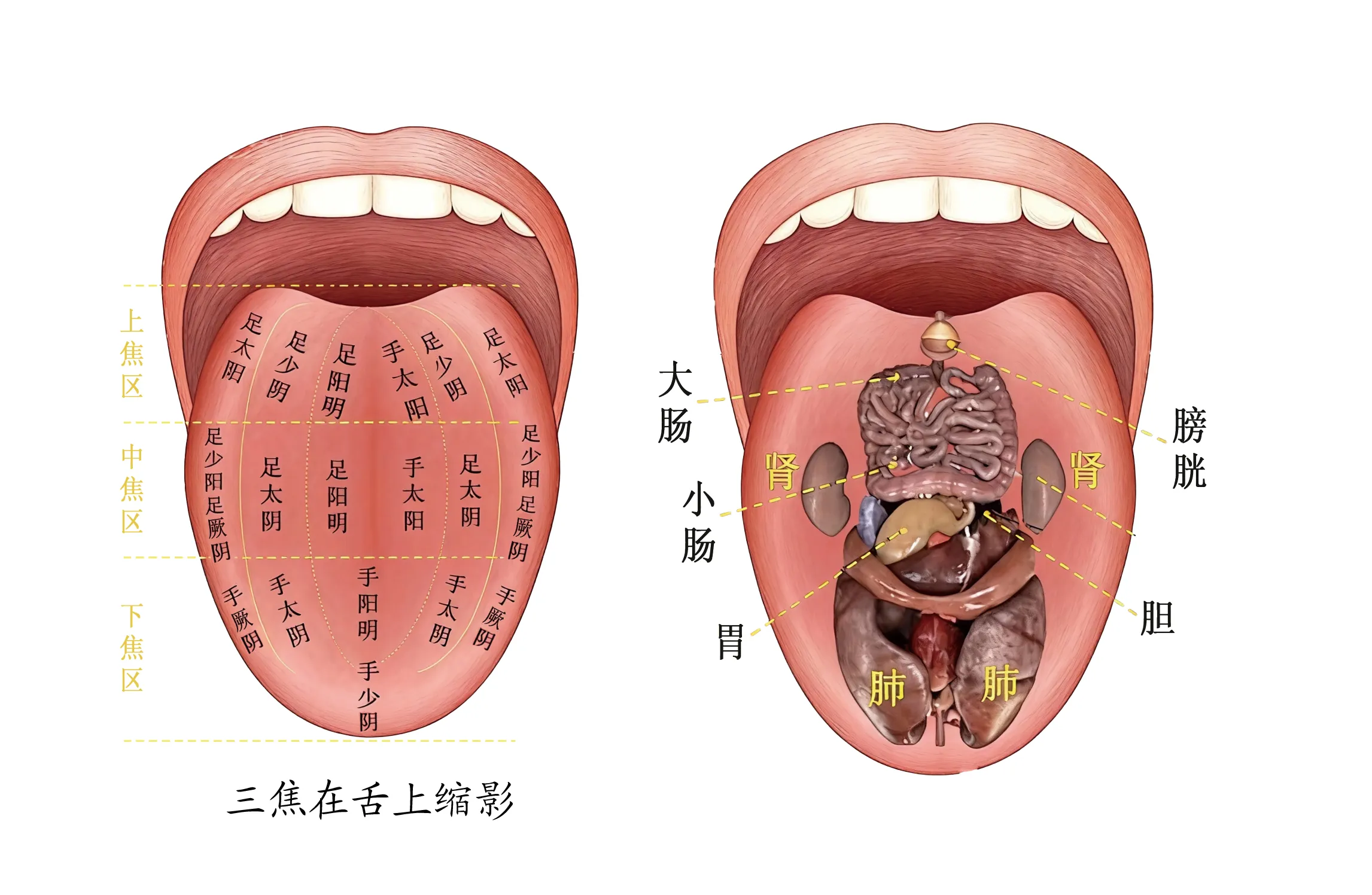 六经映射图：三焦在舌上缩影